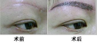 廣州哪家醫(yī)院靠譜？私立醫(yī)美口碑排行榜來襲！