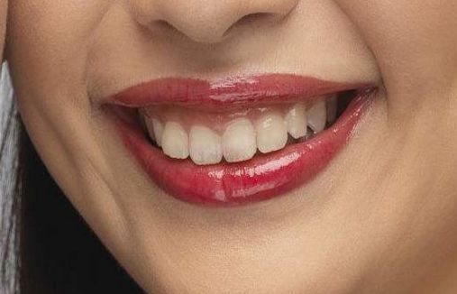 2023年北京近視手術(shù)高手引領(lǐng)潮流，瞿長(zhǎng)斌、林順潮、熊瑛等五位專家資料公開！