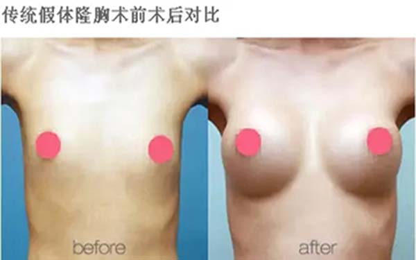 首選，你想知道成都素美脂肪填充的表現(xiàn)如何？！其次，成都素美脂肪填充的效果如何呢？