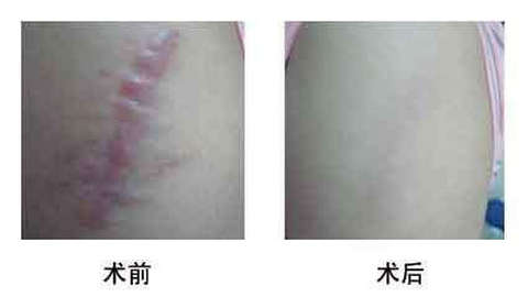 濟南有哪些人氣更高的美容整形醫(yī)院海峽和旭美如何評價