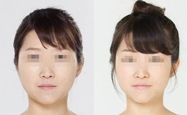 解決口臭問題的有效方法有哪些