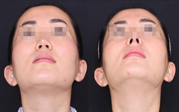 淄博麗人醫(yī)院整形美容科靠譜嗎？有口碑醫(yī)生推薦嗎？