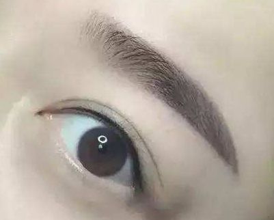 廈門哪家整形醫(yī)院口碑好？專家推薦薇格、中山前三！