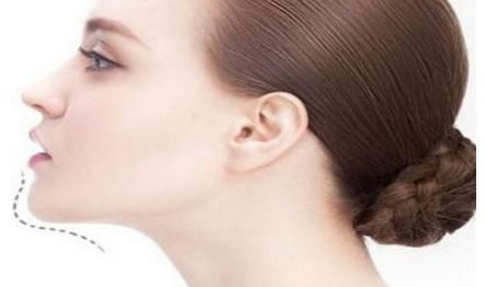 江門植發(fā)醫(yī)院專業(yè)推薦！華美植發(fā)、瑪恩植發(fā)被廣大客戶一致好評！