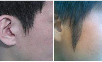 西安著名拉皮手術(shù)醫(yī)生推薦！專家團(tuán)隊(duì)不俗技藝，魯禮新、楊萬忠亮相