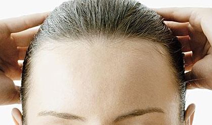 郭建玲雙眼皮修復(fù)費(fèi)用揭秘！看真實(shí)案例圖分享，了解其技術(shù)效果！