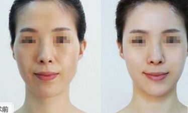 郴州市十佳整形醫(yī)院盤點(diǎn)，名醫(yī)推薦，千萬不要錯過！