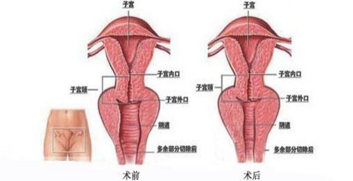 上海九院哪里能夠得到專業(yè)的隆鼻手術(shù)？排行榜最新推薦五位頂尖隆鼻專家