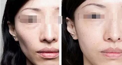 廈門整容醫(yī)院實(shí)力排名揭曉，輕松擁有美麗容顏！