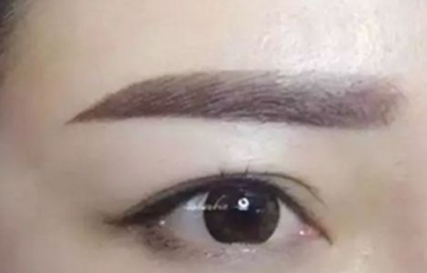 南昌美伊爾醫(yī)院的劉立軍醫(yī)生手術(shù)實(shí)力如何？擅長(zhǎng)哪些手術(shù)？附真實(shí)案例為參考