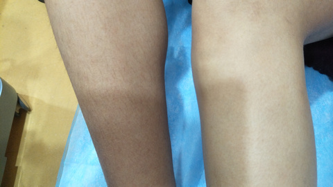 湘西自治州人民醫(yī)院燒傷美容整形科是否能滿足療效和口碑的雙重期望？有哪些備受推崇的醫(yī)生值得推薦？