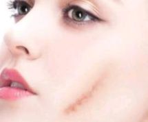 北京雙眼皮技術(shù)出色的醫(yī)院榜單，手術(shù)滿意度高贊醫(yī)院共享