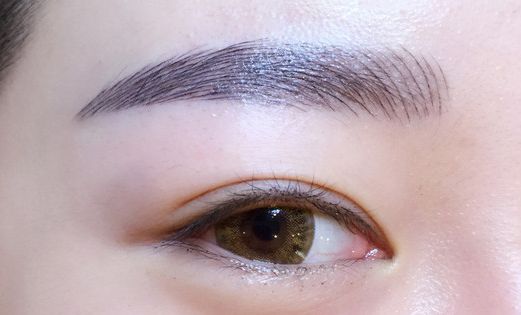 徐利剛：杭州藝星整形臨床實(shí)力派！鼻子整形解析，案例詳解！