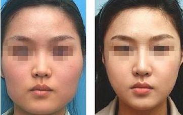 南通瘦身整形醫(yī)院哪家專業(yè)？