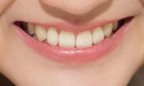 韓國腰腹環(huán)吸哪里好？必當歸、Qline、夢想吸脂瘦腰腹推薦