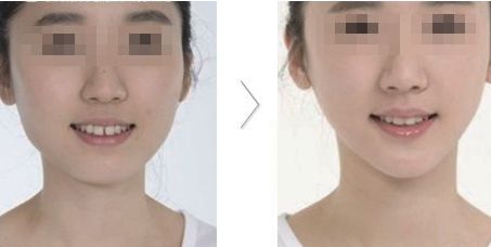 哪家醫(yī)院在北京具有卓越的醫(yī)美科技和服務(wù)？歐洲醫(yī)學(xué)中心、北京協(xié)和、北大人民醫(yī)院等公立單位有何特色？
