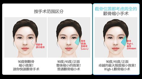 成都康橋眼科醫(yī)院美容科的評價(jià)及價(jià)格費(fèi)用推薦