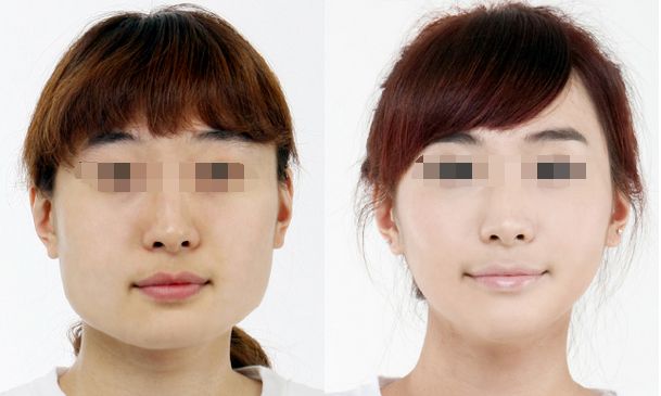 楊冪劉愷威傳授唇部護(hù)理秘訣，打造嬌嫩雙唇