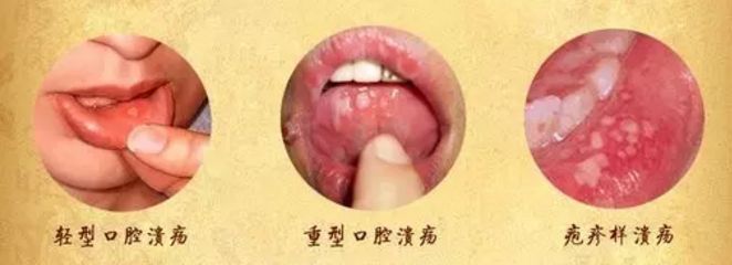北京眼袋整形醫(yī)院排名大揭秘，最佳去眼袋選擇！