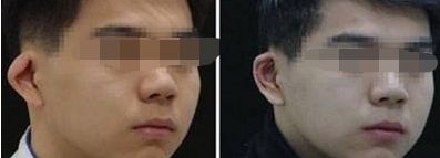 北京三甲隆胸醫(yī)院排名公布：哪家醫(yī)院技術(shù)過硬，值得信賴？