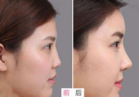 相山愛美爾醫(yī)療美容門診部，多項特色項目亮相，幫助您煥發(fā)美麗