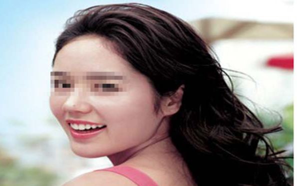 烏魯木齊哪家整形醫(yī)院的口碑比較好？