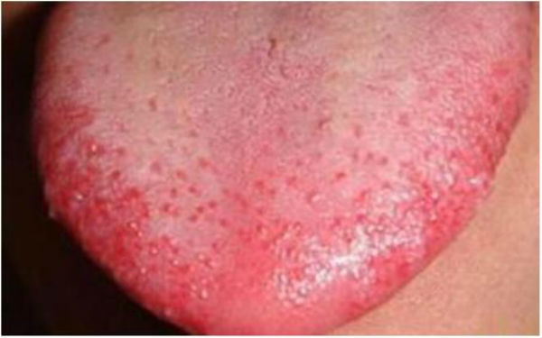 貴陽(yáng)360度私密環(huán)形緊縮術(shù)醫(yī)生