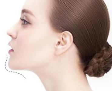 南通腿脫毛醫(yī)生