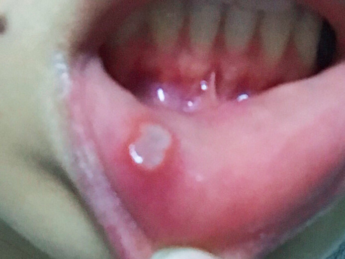 宜春注射瘦臉瘦小腿醫(yī)生