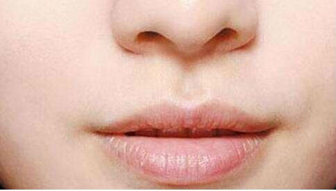 廈門(mén)眼鼻五官精細(xì)整形醫(yī)生