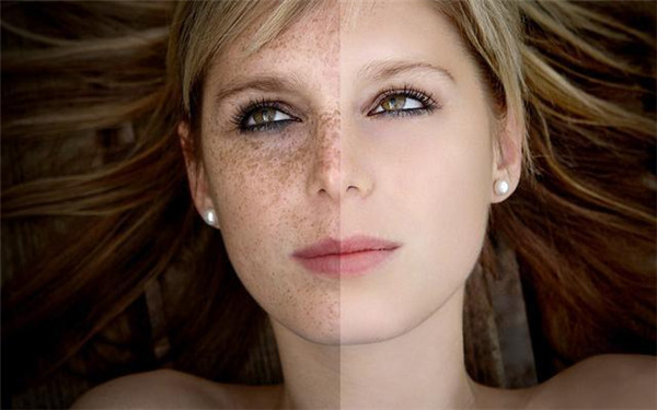 東莞臉部祛黑痣醫(yī)生