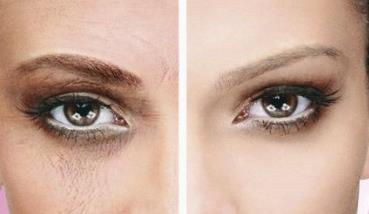 貴州靜態(tài)紋手術(shù)祛除醫(yī)生