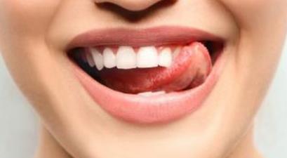 武漢光子去除黑眼圈醫(yī)生