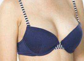 長沙手術(shù)祛除眉間紋醫(yī)生