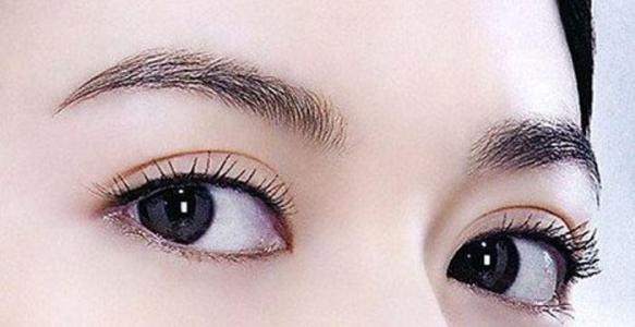 江門眼袋內(nèi)切除醫(yī)生