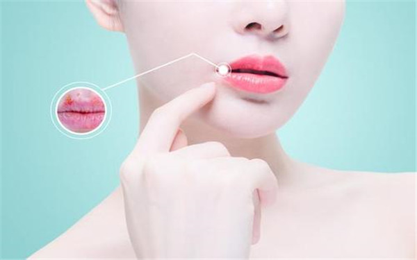 包頭去除魚尾紋醫(yī)生