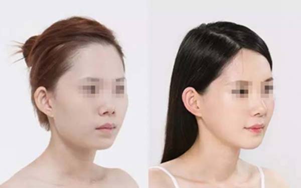 新鄉(xiāng)激光修復(fù)眼底靜態(tài)紋醫(yī)生