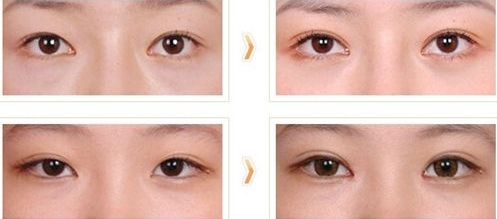 南陽(yáng)眼鼻修復(fù)再造醫(yī)生