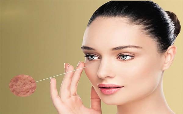 深圳肉毒素填充川字紋醫(yī)生