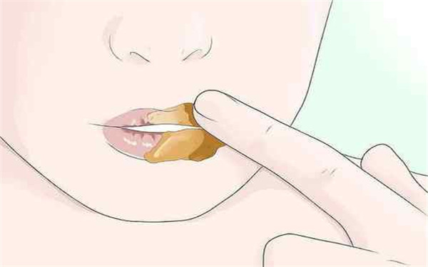 長(zhǎng)沙超聲波除皺醫(yī)生