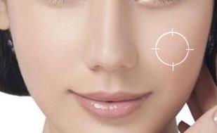 貴州激光修復靜態(tài)紋醫(yī)生