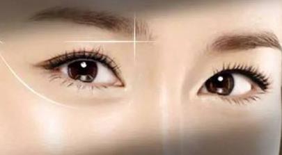 山東7d精雕隆鼻醫(yī)生