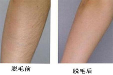 上海面部疤痕凹陷修復(fù)醫(yī)生