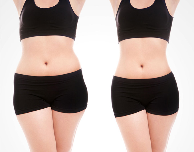 廣州頸紋填充嗨體醫(yī)生