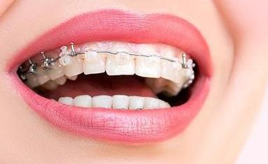 昆明玻尿酸去印第安紋醫(yī)生