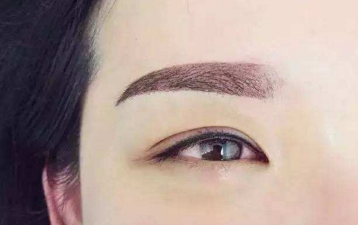 廊坊拉皮手術除皺醫(yī)生