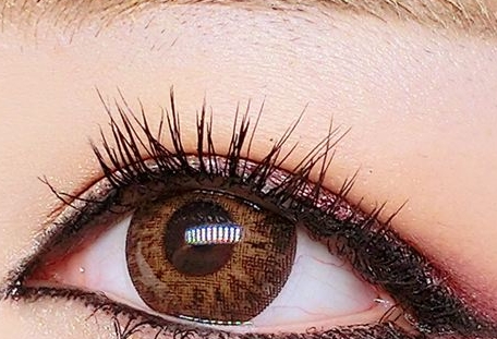 青?；瘜W(xué)剝脫祛鮮紅斑痣醫(yī)生