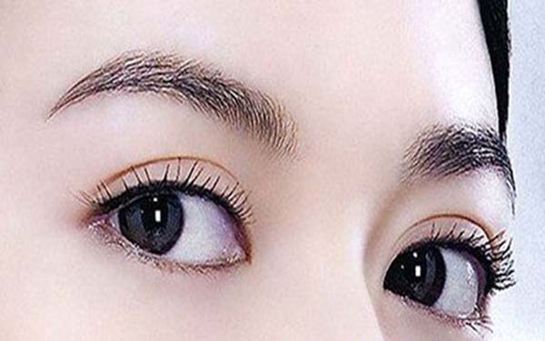 滕州激光祛除額頭紋醫(yī)生