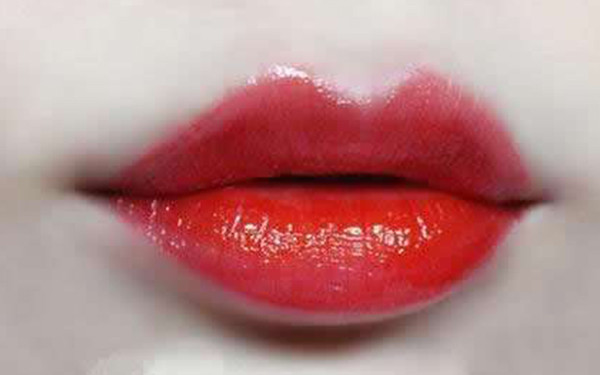 貴陽玻尿酸祛疤痕醫(yī)生