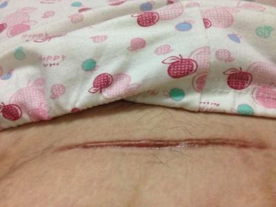 西安面部吸脂美容術醫(yī)生